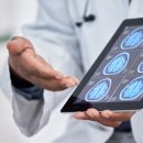 “45세에 뇌 MRI 한 번 찍었을 뿐인데”···기대 수명·치매 위험까지 안다?﻿ 이미지