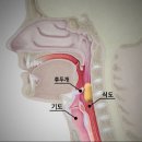 ﻿음식물 먹다가 기도가 막혔을 때 이미지