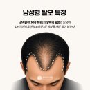 닥터최의연세마음상담의원 | 여성 정수리 모발이식, 밀도 보강이 정답인 이유 | 참닥터 chamdoctor