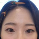 브로우드레스 이미지