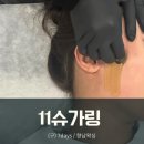 [향남] 향남왁싱 커플왁싱 &lt;11슈가링&gt; 헤어라인왁싱 후기