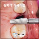 에이플란트치과의원 이미지