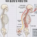 창원마취통증의학과 목디스크와 거북목통증때문에 힘들다면