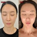목동피부관리 윤곽잘하는곳! "셀럽메디스파" 후기