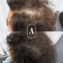 일산두피&눈썹단미토탈뷰티