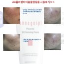 안나가스피