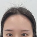 관교초등학교 | 구월동왁싱샵 쿠루뷰티 간호사출신 원장님께 헤어라인 눈썹왁싱 받고 온 솔직 후기