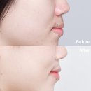 페이스헤일로와 물로만 세안한후기?