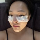 아이뽀샵 - 구미시 금오산로 213 | 눈밑 지방재배치 수술후 다크서클주사 아이공주사 시술 후기