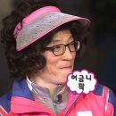 거상 | 내돈내산, 팔거상 후기, 팔거상 2년흉터,가격,통증,붓기,전후사진비교