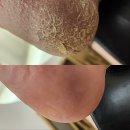 세븐일레븐 대림88타워점 | 대림발각질 거칠어진 뒤꿈치 싹 바꿔준 네일샵에스대림점