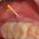 보배로운치과의원 이미지