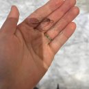 예스통상 | 갑상선 암 수술 후 실비청구, 메피품 메피겔 실비 청구 방법!