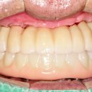 선사치과기공소 이미지