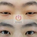 위너성형외과의원 이미지