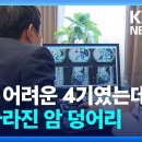 수술 어려운 4기였는데…싹 사라진 암 덩어리 이미지