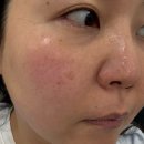 올가드림뷰티 구영점 | [울산] 피부관리, 물광관리, 예신관리로 유명한 '올가드림뷰티 구영점' 재생관리 후기