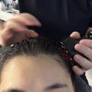 삼성메디이비인후과의원 | 평택 고덕 두피관리 전문 &#39;스칼프 메디&#39; 방문 후기