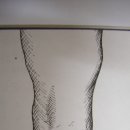 무릎검사 종류 - 정형외과 이미지