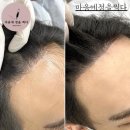 마음에점을찍다 이미지