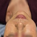 천지의료기 | (구리인창피부체형고객후기)한의사가 시키는대로 하면 복부가스로 죽을수도 있습니다~~손님은 시계반대...