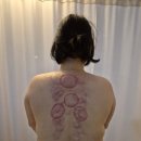 숲앤제이 에스테틱 | 논현동바디관리 체형관리 잘하는곳 숲앤제이 에스테틱 상체관리 후기