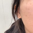 소노 | [경산 에스테틱 추천] 노어에스테틱 플라토닝&amp;쿼드소노 후기