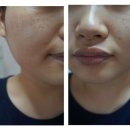 민성형외과의원 이미지