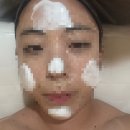 포항시북구74 | 포항_더나은스킨_포항북구피부관리샵_겨울철 두피관리 및 상체 데콜테 후기(재방문)