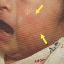 파란별한의원 네이버블로그