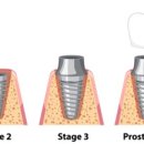 수정치과기공소 이미지