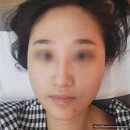 김포피부관리 뷰티하리 김포점 검단신도시 웨딩케어 결혼식 전날 스킨플래닝 리얼후기