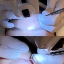 코스큐어 | 잠실 피부관리 루아에스테틱 성인 여드름 큐어아크네 후기