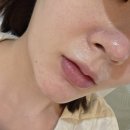 미드림인테리어 | 송도역 옥련동 피부관리 미드림 에스떼 모공관리 윤곽관리 후기