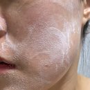 나무메디 | 메디티엔 리커버리 여드름세안제 약산성 저자극 폼클렌저 후기