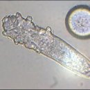 팔마헬스클럽 | 모낭충 증상 및 피부 가려움증 해결하는 방법