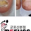 오블리뷰티&레푸스 이미지
