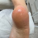 푸스케어라푼젤네일