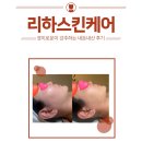 리하스킨케어 이미지