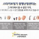 밝은귀 독일 보청기 이미지