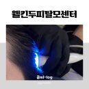 (주)인터피드 | [웰킨두피탈모센터 용인수지점]에서 두피 관리 받고 온 후기 / 두피 상태 진단, 두피 스케일링