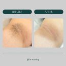 in_waxing 이미지