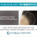 머리나라헤어라인 이미지