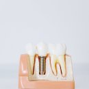 동탄미소치과의원 이미지