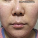 닥터코르셋 | 리프팅 V라인 닥터코스 수퍼리프팅 코르셋 마스크 사용후기