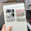 요온네일 이미지