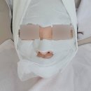 무선하나의원 | [용인] 처인구 김량장동 사각턱보톡스 잘하는 곳 | 톤즈의원 내돈내산 후기