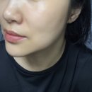 아이엠바이오 | [내돈내산] 바이오힐 보 프로바이오덤 콜라겐 리모델링 세럼 후기