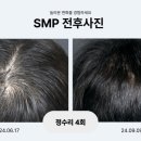 걸&보이헤어라인