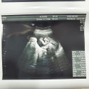 순산부인과의원 이미지